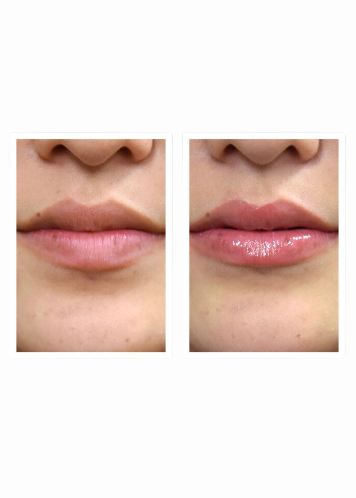 MedWell Savior Skin LipSmart